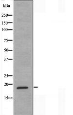 MECOM Antibody in Western Blot (WB)