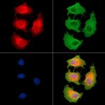 MYLK2 Polyclonal Antibody
