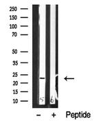 NACA Polyclonal Antibody