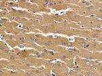 NAT14 Polyclonal Antibody