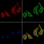 NPR3 Polyclonal Antibody