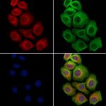 SCN5A Polyclonal Antibody