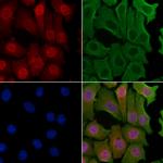 NCBP1 Antibody in Immunocytochemistry (ICC/IF)