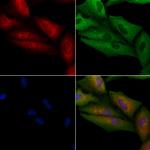 NDUFA1 Polyclonal Antibody