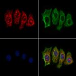 NDUFAF2 Polyclonal Antibody