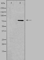 NDUFS1 Polyclonal Antibody