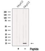 NDUFV3 Polyclonal Antibody