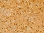 Neogenin Antibody in Immunohistochemistry (Paraffin) (IHC (P))