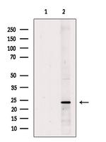 Neurturin Polyclonal Antibody