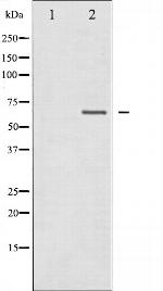 NF2 Antibody in Western Blot (WB)