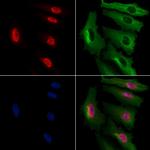NIP7 Antibody in Immunocytochemistry (ICC/IF)