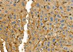 NKTR Polyclonal Antibody
