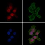 Nkx2.2 Polyclonal Antibody