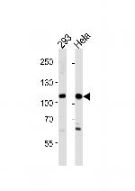 SALL4 Polyclonal Antibody