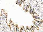 NOTCH4 Antibody in Immunohistochemistry (Paraffin) (IHC (P))
