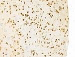 PXR Antibody in Immunohistochemistry (Paraffin) (IHC (P))
