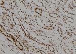 TR2 Polyclonal Antibody