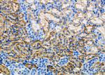 N-Ras Polyclonal Antibody