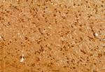 NSUN2 Antibody in Immunohistochemistry (Paraffin) (IHC (P))