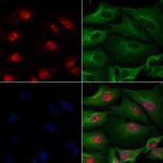 NUP98 Polyclonal Antibody