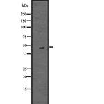 OAS1 Polyclonal Antibody