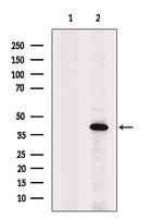 OGG1 Polyclonal Antibody