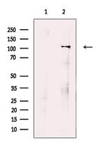 ORP1 Polyclonal Antibody