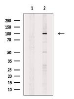 ORP1 Antibody in Western Blot (WB)