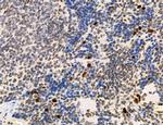 SP7 Antibody in Immunohistochemistry (Paraffin) (IHC (P))