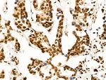 OVOL2 Antibody in Immunohistochemistry (Paraffin) (IHC (P))