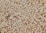 p14ARF Polyclonal Antibody