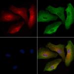 LPAR6 Antibody in Immunocytochemistry (ICC/IF)