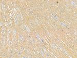 P2X3 Antibody in Immunohistochemistry (Paraffin) (IHC (P))