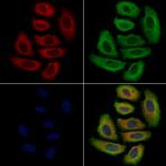 p40 Antibody in Immunocytochemistry (ICC/IF)
