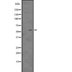 p57 Kip2 Polyclonal Antibody
