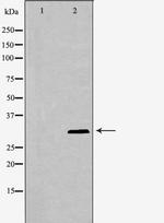 p57 Kip2 Polyclonal Antibody