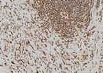 PAK7 Antibody in Immunohistochemistry (Paraffin) (IHC (P))
