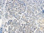 PPY Polyclonal Antibody