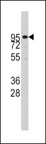 ADAM17 Polyclonal Antibody