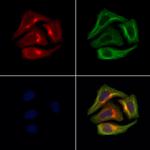 PAPPA2 Polyclonal Antibody