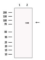 PARN Polyclonal Antibody
