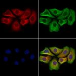 TSPO Polyclonal Antibody