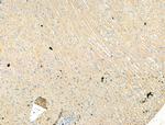TSPO Antibody in Immunohistochemistry (Paraffin) (IHC (P))