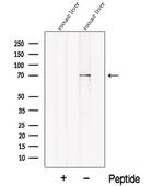 PCK2 Polyclonal Antibody