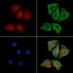 PDK1 Polyclonal Antibody