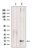 PEN2 Antibody in Western Blot (WB)