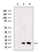 PFDN6 Antibody in Western Blot (WB)