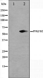 PFKFB2 Polyclonal Antibody