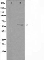 PFKFB2 Polyclonal Antibody
