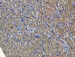 PGAM2 Antibody in Immunohistochemistry (Paraffin) (IHC (P))